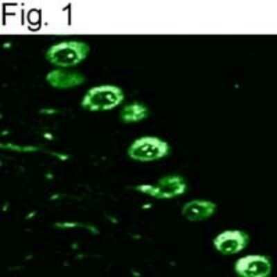 Immunocytochemistry/ Immunofluorescence: IP3R1 Antibody [NBP2-22458]