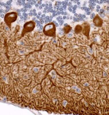 Immunohistochemistry-Paraffin: IP3R1 Antibody [NBP1-21398]