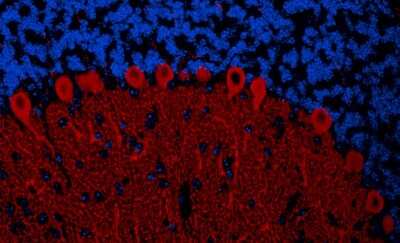 Immunohistochemistry-Paraffin: IP3R1 Antibody [NBP1-21398]