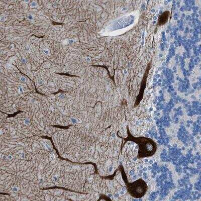 Immunohistochemistry-Paraffin: IP3R1 Antibody [NBP1-83104]