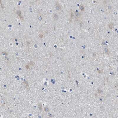 Immunohistochemistry-Paraffin: IP3R1 Antibody [NBP1-83104]