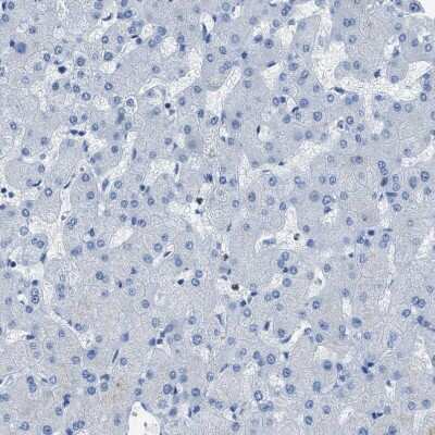 Immunohistochemistry-Paraffin: IP3R1 Antibody [NBP1-83104]