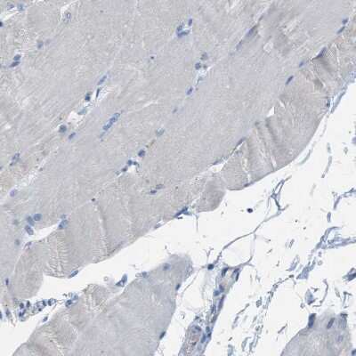 Immunohistochemistry-Paraffin: IP3R1 Antibody [NBP1-83104]