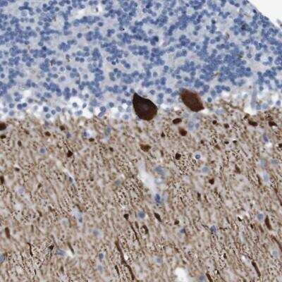 Immunohistochemistry-Paraffin: IP3R1 Antibody [NBP1-83105]