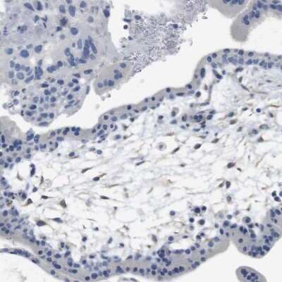Immunohistochemistry-Paraffin: IP3R1 Antibody [NBP1-83105]