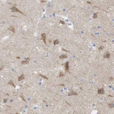 Immunohistochemistry-Paraffin: IP3R1 Antibody [NBP1-83105]