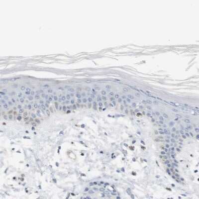 Immunohistochemistry-Paraffin: IP3R1 Antibody [NBP1-83105]
