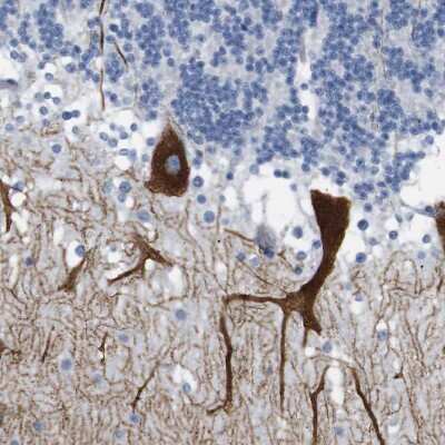 Immunohistochemistry-Paraffin: IP3R1 Antibody [NBP1-83105]
