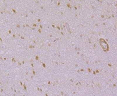 Immunohistochemistry-Paraffin: IP3R1 Antibody [NBP3-09066]