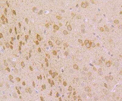 Immunohistochemistry-Paraffin: IP3R1 Antibody [NBP3-09066]