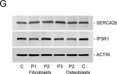 Western Blot: IP3R1 Antibody [NB120-5908]