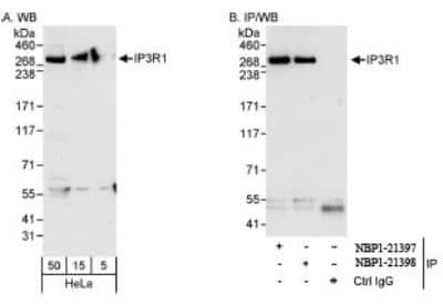 Western Blot: IP3R1 Antibody [NBP1-21398]