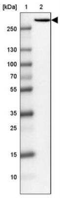 Western Blot: IP3R1 Antibody [NBP1-83105]