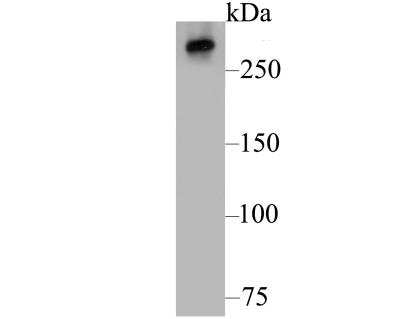 Western Blot: IP3R1 Antibody [NBP3-09066]