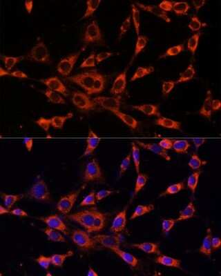 Immunocytochemistry/ Immunofluorescence: IP3R3 Antibody - Azide and BSA Free [NBP3-03498]