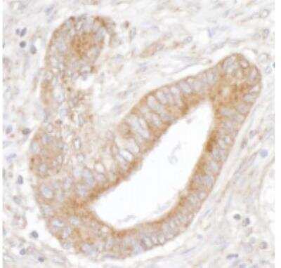 Immunohistochemistry-Paraffin: IP3R3 Antibody [NBP1-21399]