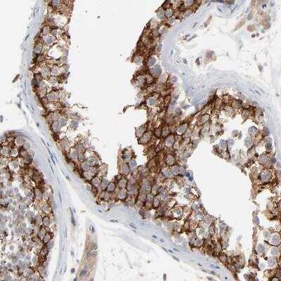 Immunohistochemistry-Paraffin: IP3R3 Antibody [NBP1-83101]