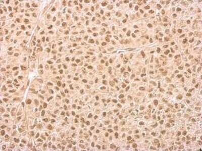 Immunohistochemistry-Paraffin: IP6K1 Antibody (10611) [NBP2-43667]