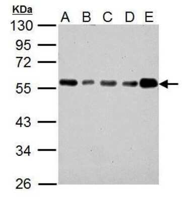 Western Blot: IP6K1 Antibody (10611) [NBP2-43667]