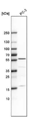 Western Blot: IP6K1 Antibody [NBP1-92026]