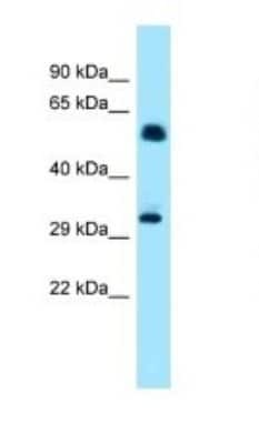 Western Blot: IP6K1 Antibody [NBP1-98398]