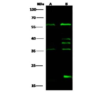 Western Blot: IP6K1 Antibody [NBP3-00228]