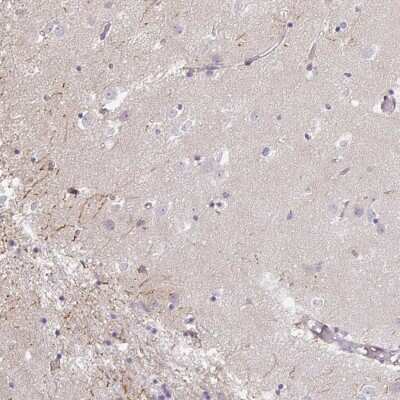 Immunohistochemistry-Paraffin: IP6K3 Antibody [NBP2-33689]