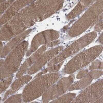 Immunohistochemistry-Paraffin: IP6K3 Antibody [NBP3-17386]