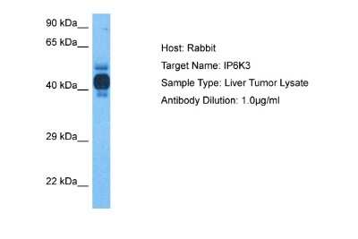 Western Blot: IP6K3 Antibody [NBP2-85097]