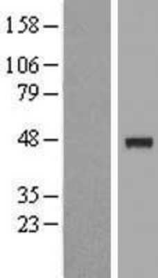 Western Blot: IP6K3 Overexpression Lysate [NBP2-09673]