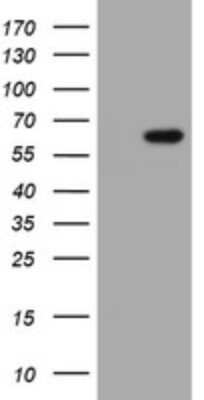 Western Blot: IPCEF1 Antibody (OTI3G2) [NBP2-45765]