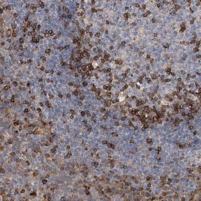Immunohistochemistry-Paraffin: IPCEF1 Antibody [NBP1-83010]