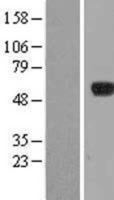 Western Blot: IPCEF1 Overexpression Lysate [NBL1-14431]