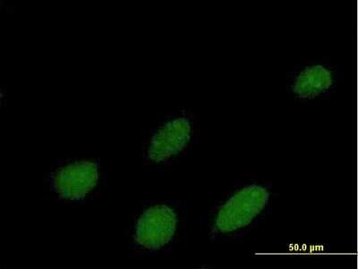 Immunocytochemistry/ Immunofluorescence: IPMK Antibody [H00253430-B01P]