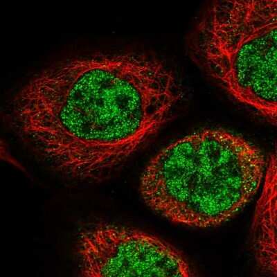 Immunocytochemistry/ Immunofluorescence: IPMK Antibody [NBP1-89426]