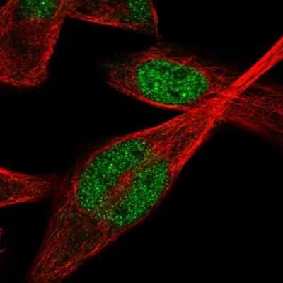 Immunocytochemistry/ Immunofluorescence: IPMK Antibody [NBP2-57192]