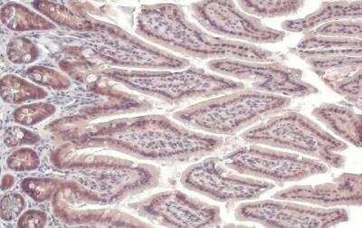Immunohistochemistry-Paraffin: IPMK Antibody [NBP1-32250]