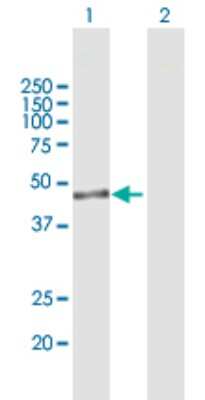 Western Blot: IPMK Antibody [H00253430-B01P]