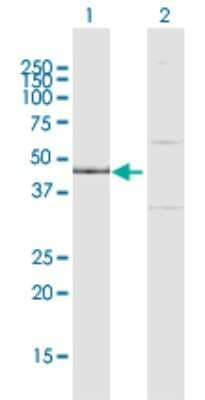 Western Blot: IPMK Antibody [H00253430-D01P]