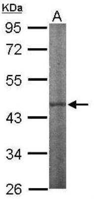 Western Blot: IPMK Antibody [NBP1-32250]