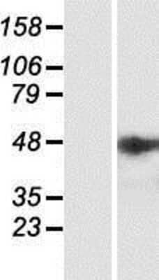 Western Blot: IPMK Overexpression Lysate [NBP2-05419]