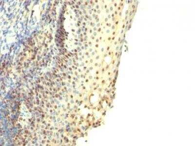 Immunohistochemistry-Paraffin: IPO-38 Antibody (IPO-38) - IHC-Prediluted [NBP2-48275]