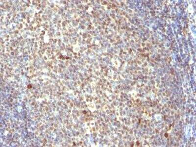 Immunohistochemistry-Paraffin: IPO-38 Antibody (IPO-38) - IHC-Prediluted [NBP2-48275]