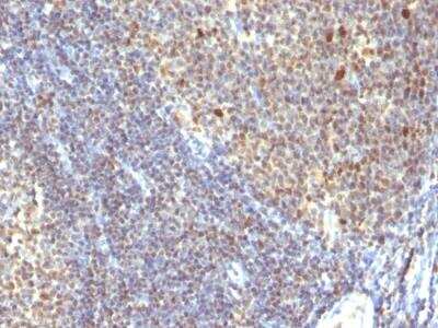 Immunohistochemistry-Paraffin: IPO-38 Antibody (SPM260) - IHC-Prediluted [NBP2-48276]