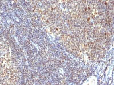 Immunohistochemistry-Paraffin: IPO-38 Antibody (SPM260) [NBP2-45203]