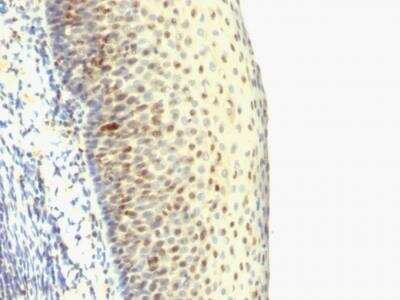 Immunohistochemistry-Paraffin: IPO-38 Antibody (SPM515) - IHC-Prediluted [NBP2-48301]
