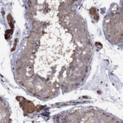 Immunohistochemistry-Paraffin: IPP Antibody [NBP3-17387]