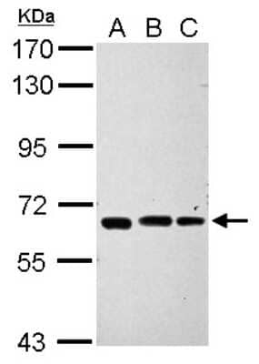 Western Blot: IPP Antibody [NBP2-16984]