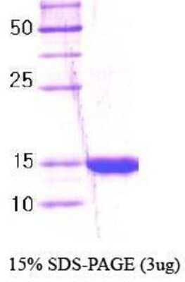 SDS-PAGE: Recombinant Human IPP Protein [NBC1-18418]