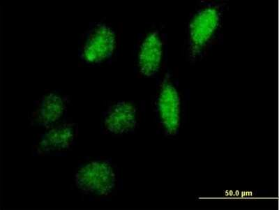 Immunocytochemistry/ Immunofluorescence: IPPK Antibody [H00064768-B01P]
